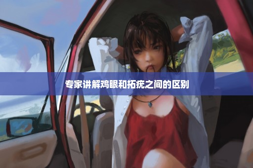 专家讲解鸡眼和拓疣之间的区别