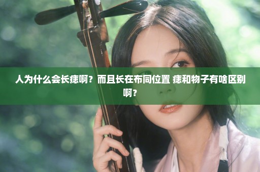 人为什么会长痣啊？而且长在布同位置 痣和物子有啥区别啊？