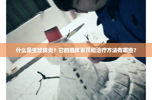 什么是虫咬皮炎？它的临床表现和治疗方法有哪些？