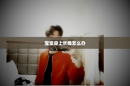 宝宝身上长癣怎么办