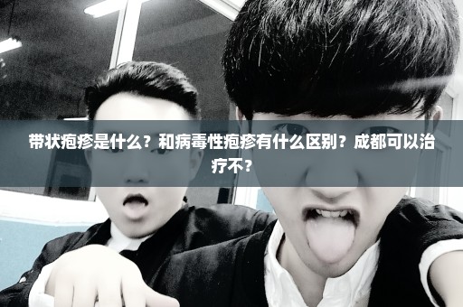 带状疱疹是什么？和病毒性疱疹有什么区别？成都可以治疗不？