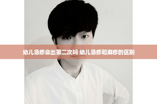 幼儿急疹会出第二次吗 幼儿急疹和麻疹的区别