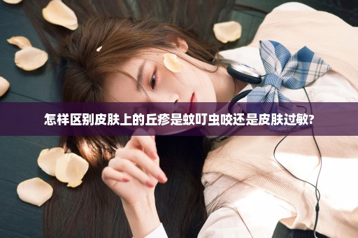 怎样区别皮肤上的丘疹是蚊叮虫咬还是皮肤过敏?