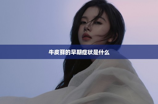 牛皮藓的早期症状是什么