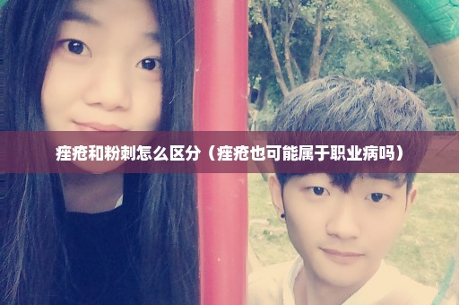 痤疮和粉刺怎么区分（痤疮也可能属于职业病吗）
