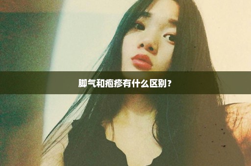 脚气和疱疹有什么区别？