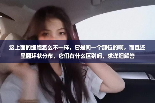 这上面的细胞怎么不一样，它是同一个部位的啊，而且还呈圆环状分布，它们有什么区别吗，求详细解答